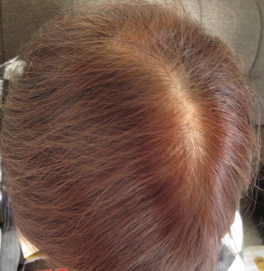 白髪染めDHCQ10クイックカラートリートメントを使っている母親の髪